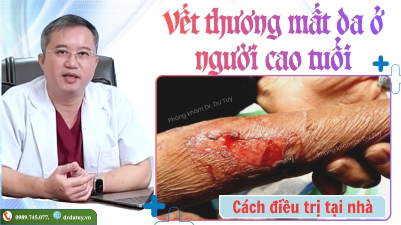 vet-thuong-mat-da-o-nguoi-cao-tuoi