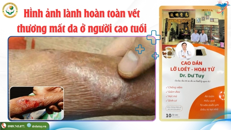 vet-thuong-mat-da-sau-hoi-phuc