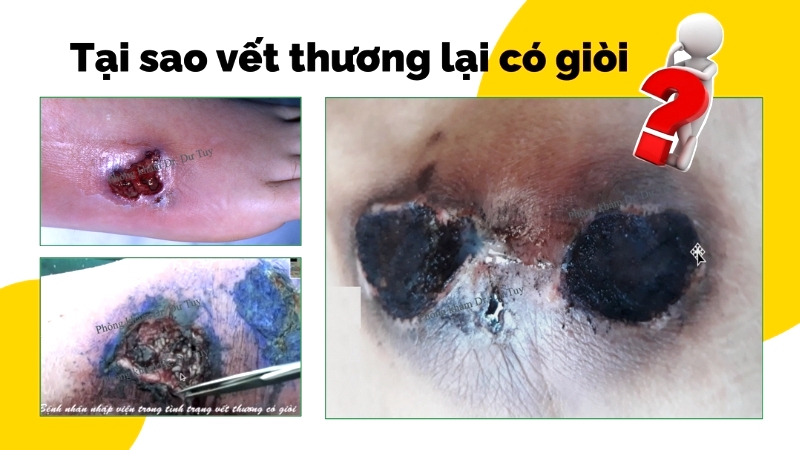 vet-thuong-ngoai-da-nho-de-bi-chu-quan