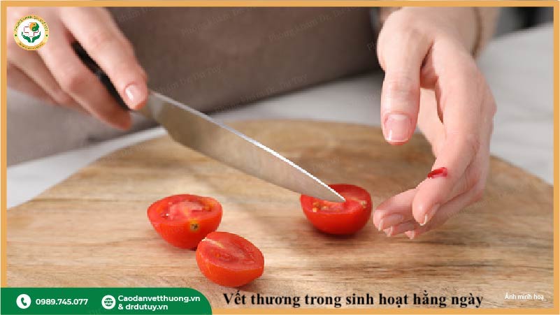 vet-thuong-ngoai-da-trong-sinh-hoat-hang-ngay