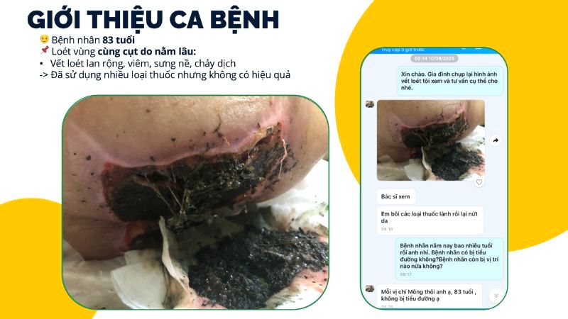 vet-tray-nho-vung-cung-cut-nguoi-cao-tuoi