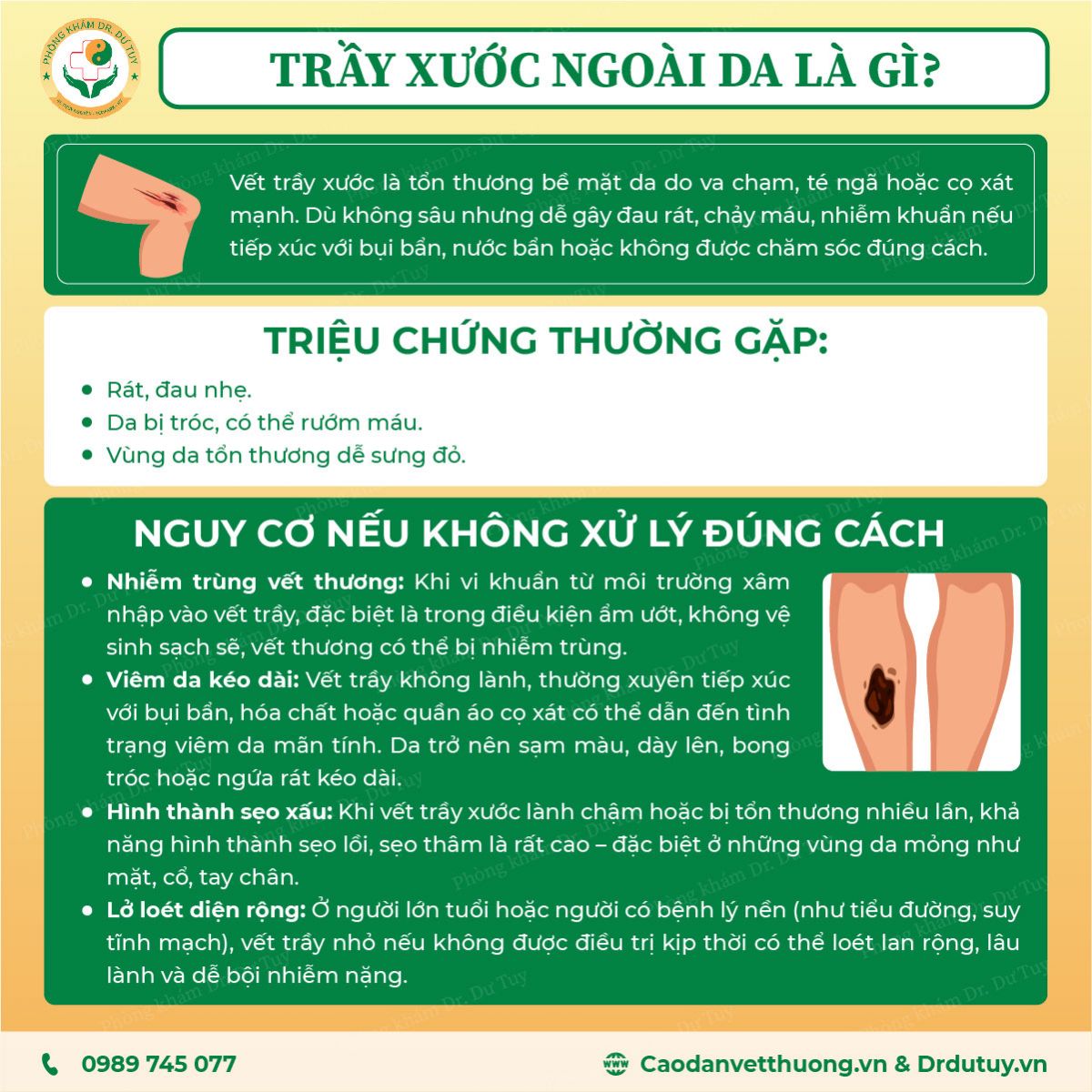 vet-tray-xuoc-nho-cung-co-the-gay-viem-loet-da2