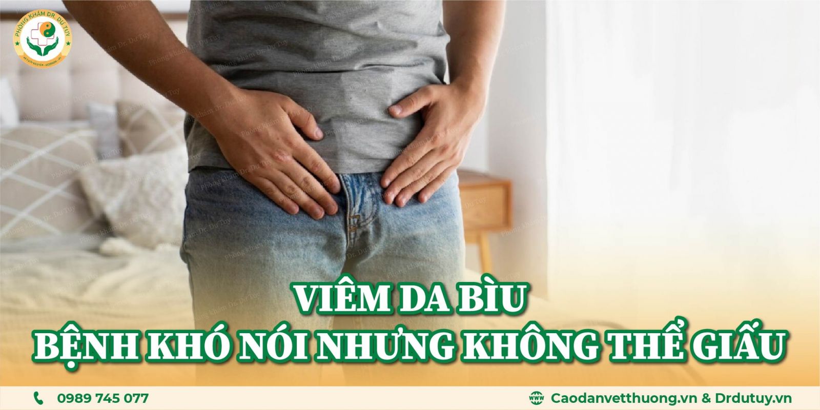 viem-da-biu-benh-kho-noi-nhung-khong-the-giau