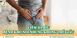 Viêm Da Bìu: Bệnh Khó Nói Nhưng Không Thể Giấu