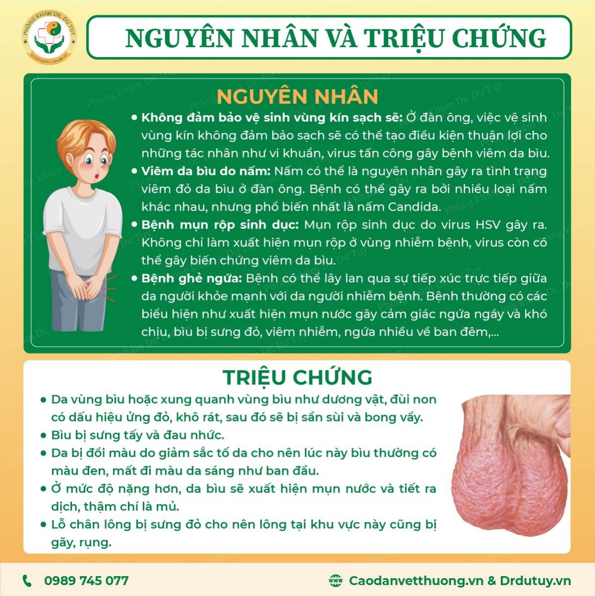 viem-da-biu-benh-kho-noi-nhung-khong-the-giau2