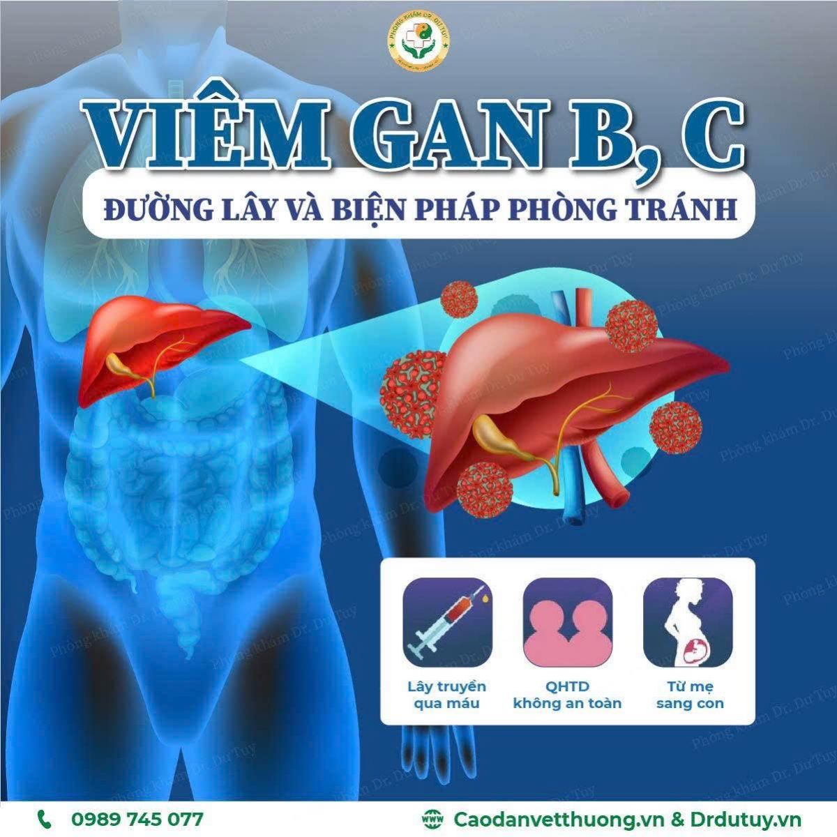 viem-gan-b-c-duong-lay-truyen-va-cach-phong-tranh