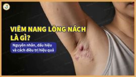 Viêm nang lông nách: Nguyên nhân, dấu hiệu và giải pháp điều trị dứt điểm