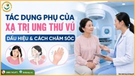 Xạ Trị Ung Thư Vú Có Tác Dụng Phụ Gì? Dấu Hiệu Nhận Biết Và Cách Xử Trí An Toàn