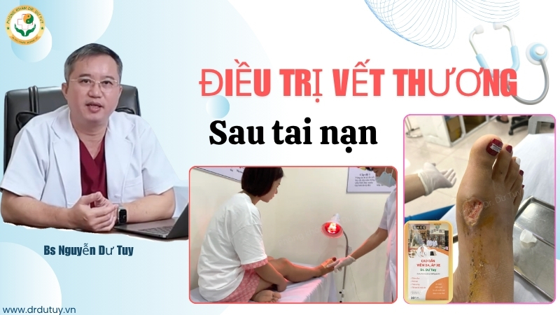xu-ly-vet-thuong-mat-da-sau-tai-nan