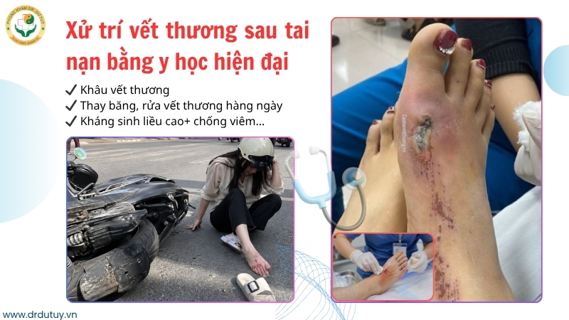 xu-tri-vet-thuong-sau-tai-nan-xe-may