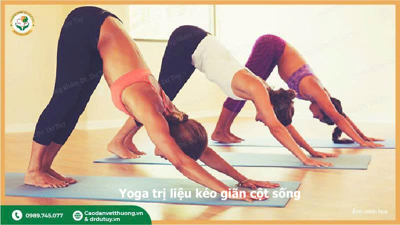 yoga-giam-dau-than-kinh-toa-tu-the-cho-up-mat