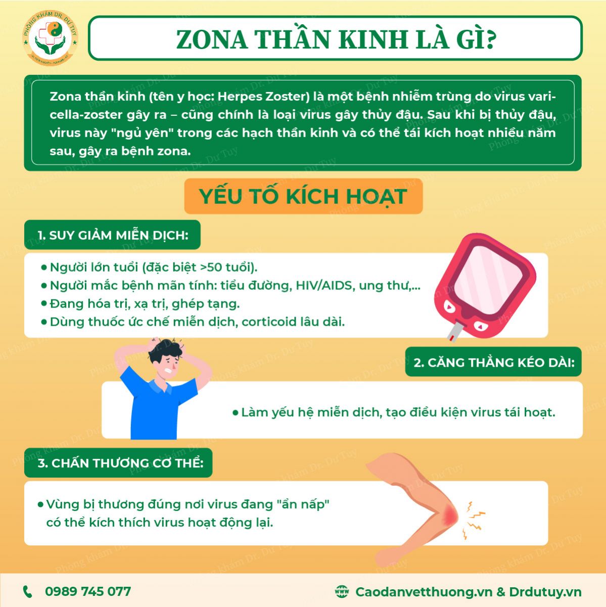 zona-than-kinh-nguyen-nhan-trieu-chung-cach-phong-tranh-va-dieu-tri-hieu-qua-tai-nha2