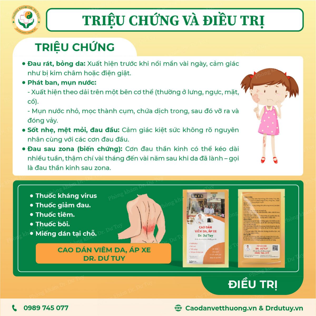 zona-than-kinh-nguyen-nhan-trieu-chung-cach-phong-tranh-va-dieu-tri-hieu-qua-tai-nha3